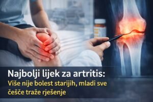 Najbolji lijek za artritis