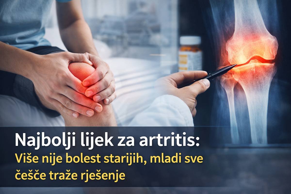 Najbolji lijek za artritis